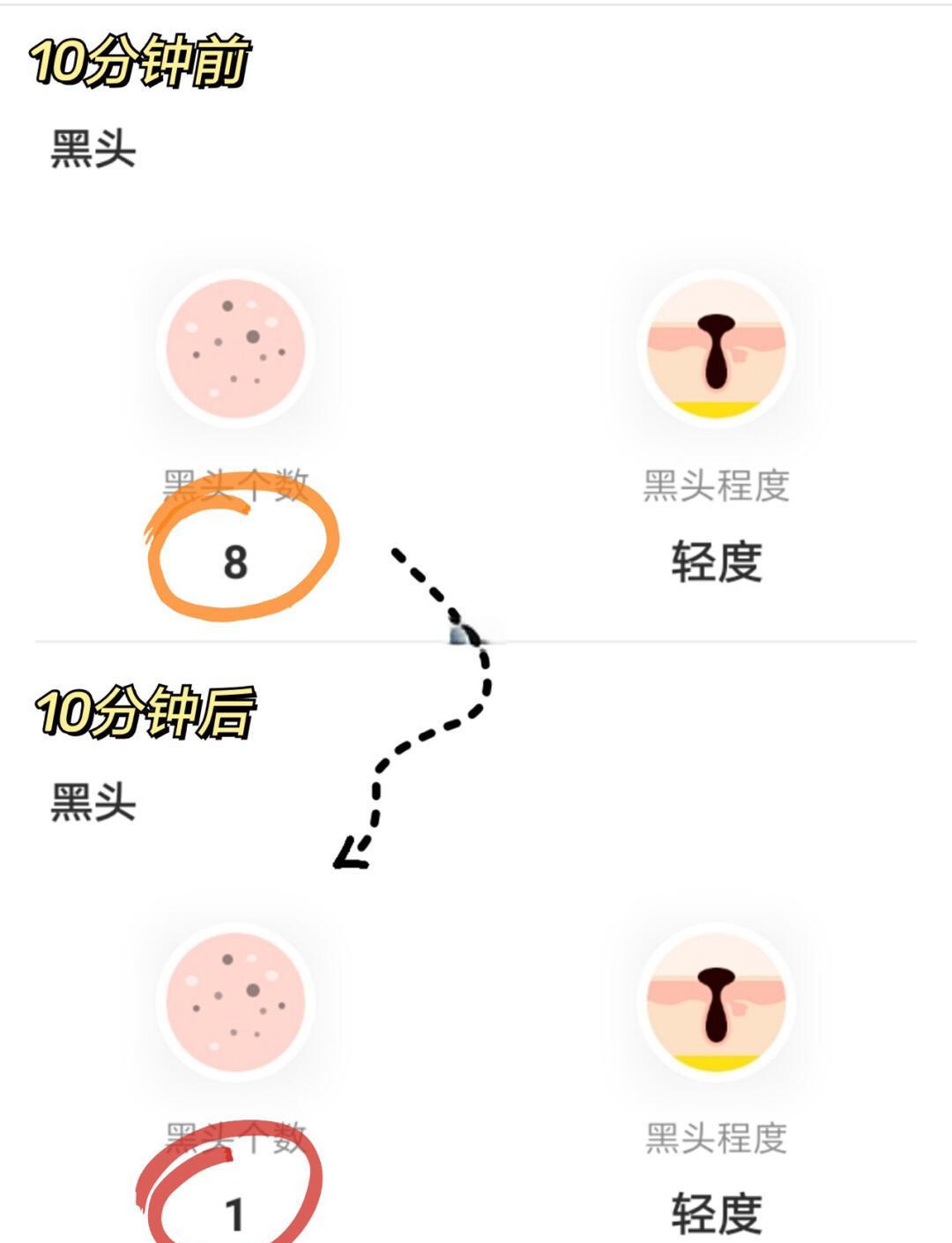 去黑头的小方法